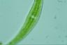 Closterium moniliferum