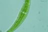 Closterium moniliferum