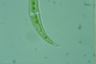 Closterium leibleinii