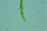 Closterium dianae