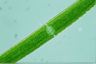 Closterium acerosum