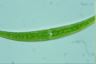 Closterium rostratum