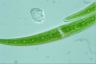 Closterium rostratum