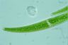 Closterium rostratum