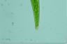 Closterium rostratum