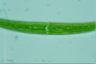 Closterium rostratum