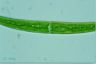 Closterium rostratum