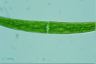 Closterium rostratum