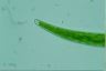 Closterium rostratum