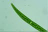 Closterium intermedium