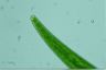 Closterium intermedium