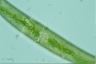 Closterium costatum