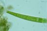 Closterium intermedium