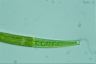 Closterium intermedium