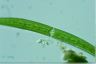 Closterium intermedium