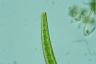 Closterium intermedium