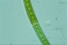 Closterium intermedium