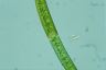 Closterium intermedium