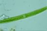 Closterium intermedium