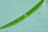 Closterium intermedium