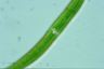 Closterium intermedium