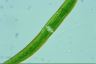 Closterium intermedium