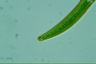 Closterium intermedium