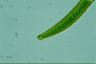 Closterium intermedium