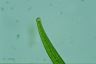 Closterium intermedium