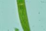 Closterium costatum