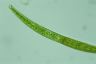 Closterium intermedium