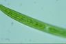 Closterium intermedium