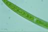 Closterium intermedium