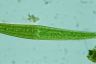 Closterium ralfsii