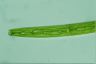 Closterium baillyanum