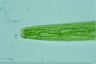 Closterium baillyanum