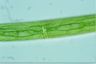 Closterium baillyanum