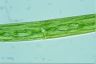 Closterium baillyanum