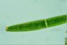 Closterium baillyanum