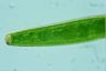 Closterium baillyanum