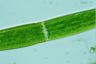 Closterium baillyanum