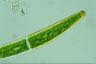 Closterium baillyanum