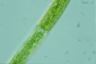 Closterium intermedium