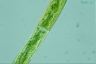 Closterium intermedium