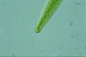 Closterium intermedium