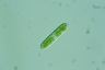 Cylindrocystis