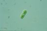 Cylindrocystis