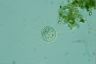 Acanthocystis