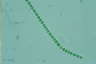 Anabaena