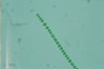 Anabaena